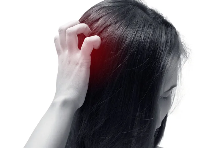 Da đầu nhạy cảm là gì? Nhận diện “kẻ gây rối” cho mái tóc