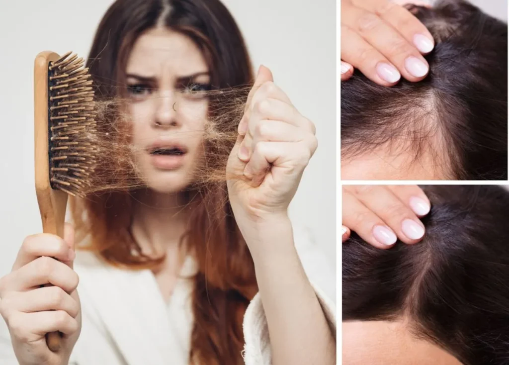 Rụng tóc sinh lý: Khi nào là bình thường?