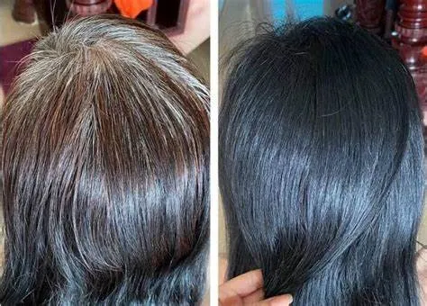 Sử dụng các biện pháp tự nhiên: "Bài thuốc" từ dân gian