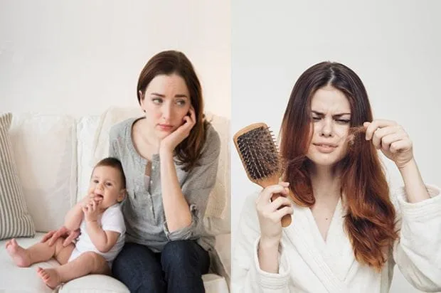 Tại sao mẹ sau sinh lại bị rụng tóc nhiều? Điểm danh các nguyên nhân chính