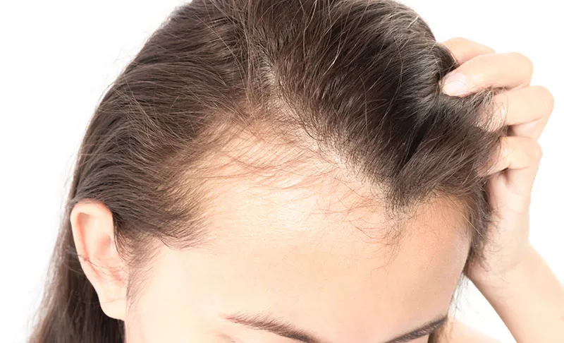Tránh các tác động mạnh lên da đầu
