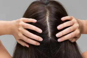 Cách chăm sóc da đầu nhạy cảm