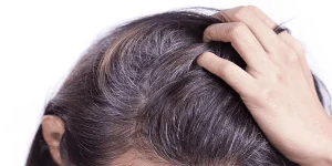Cách chăm sóc tóc bạc sớm
