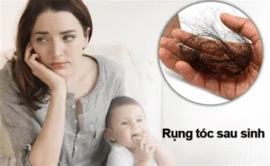 Cách giảm rụng tóc sau sinh