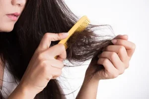 Cách ngăn ngừa tóc gãy rụng