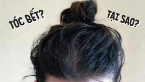 Tóc dầu nên dùng dầu gội gì