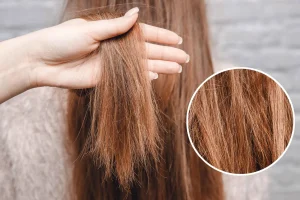 Tóc nhuộm bị khô nên làm gì